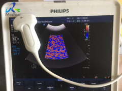 Philips C5-1 Epiq/CX50/Affinit i Ultrasound Probe