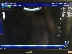 GE 4C convex array transducer