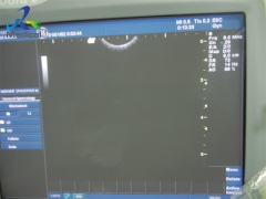 GE E8C transvaginal ultrasound transducer probe