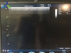 GE 9L-RS Linear array Multi-angle Ultrasound Probe