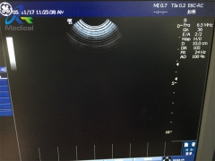 GE E6C-RC curved linear array Ultrasound probe