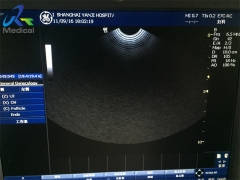 GE E7C-RC wide band microconvex ultrasound transducer