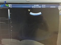 GE 4C-D Convex Array abdominal transducer