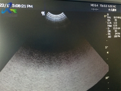 GE 6.5C-RC wide band abdominal microconvex Ultrasound transducer