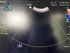 Philips C5-1(EPIQ) Curved Array Ultrasound Probe