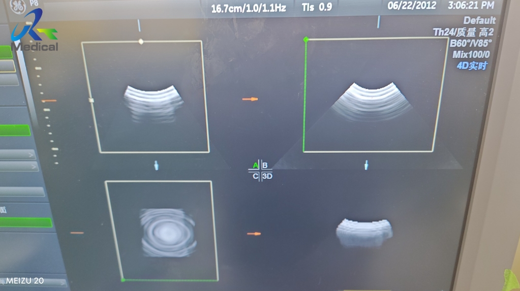 Repair Ultrasound Probe GE RAB2-6-RS Transducer